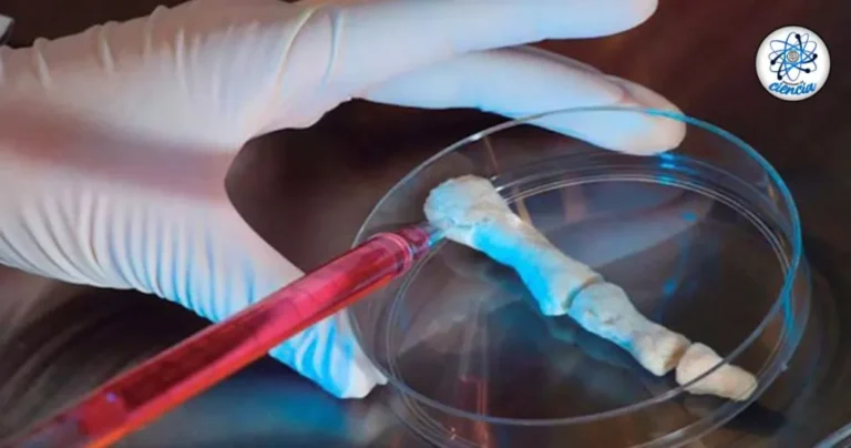 Científicos crean gel innovador que regenera huesos dañados