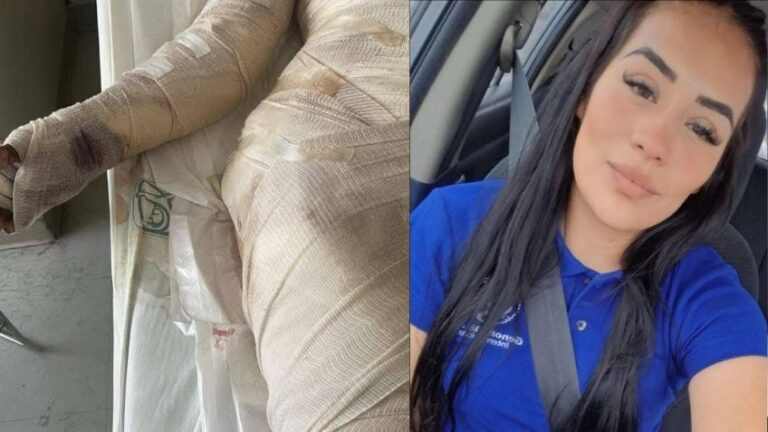 Mujer lucha por su vida tras ser víctima de intento de abuso y brutal ataque con gasolina en Ciudad Juárez