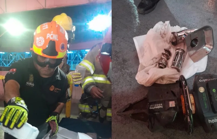 Bebé de un año pierde su mano en trágico accidente con máquina de carne