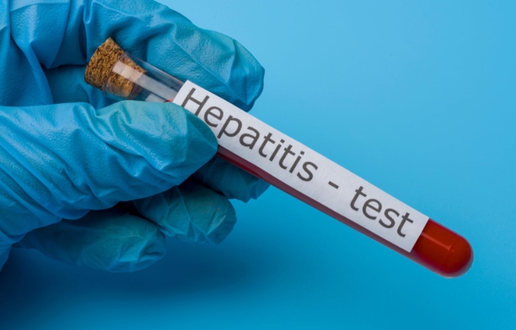OMS lanza alerta global por hepatitis: cada 30 segundos muere una persona por esta enfermedad