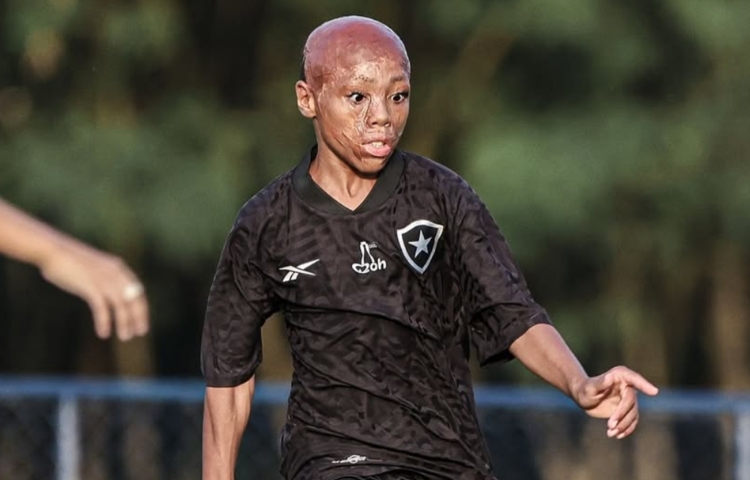 De sobrevivir a un accidente a brillar en Botafogo: la historia de Bernardo Lopes