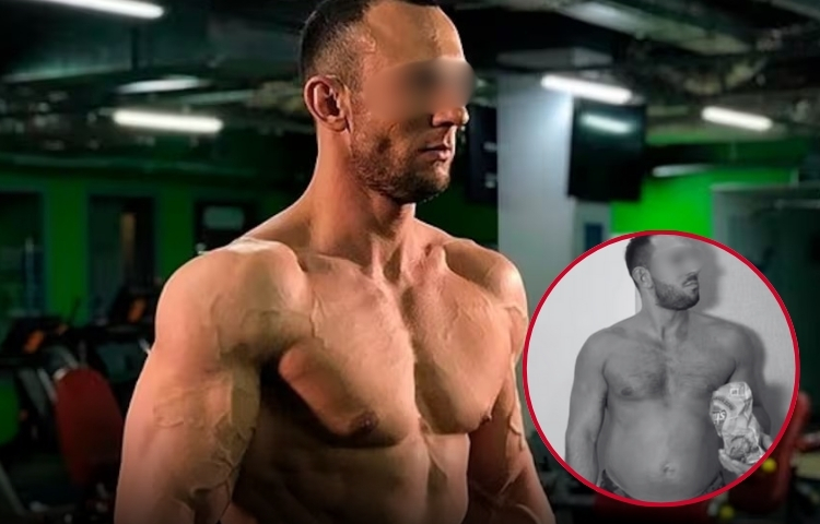 Reto de aumento de peso extremo acaba con la vida de influencer ruso
