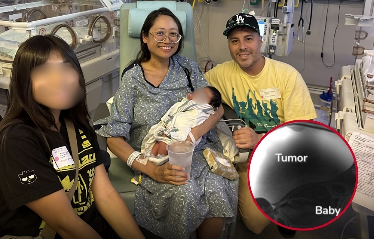 Mujer iba a operarse por un tumor y médicos hallan un bebé fuera del útero